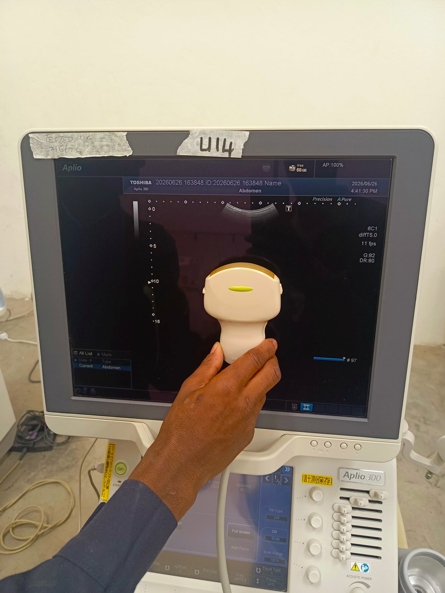 Toshiba aplio 300 ultrasound with convex probeandTVS probe Refurbished equipment. BH