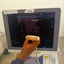 Toshiba aplio 300 ultrasound with convex probeandTVS probe Refurbished equipment. BH