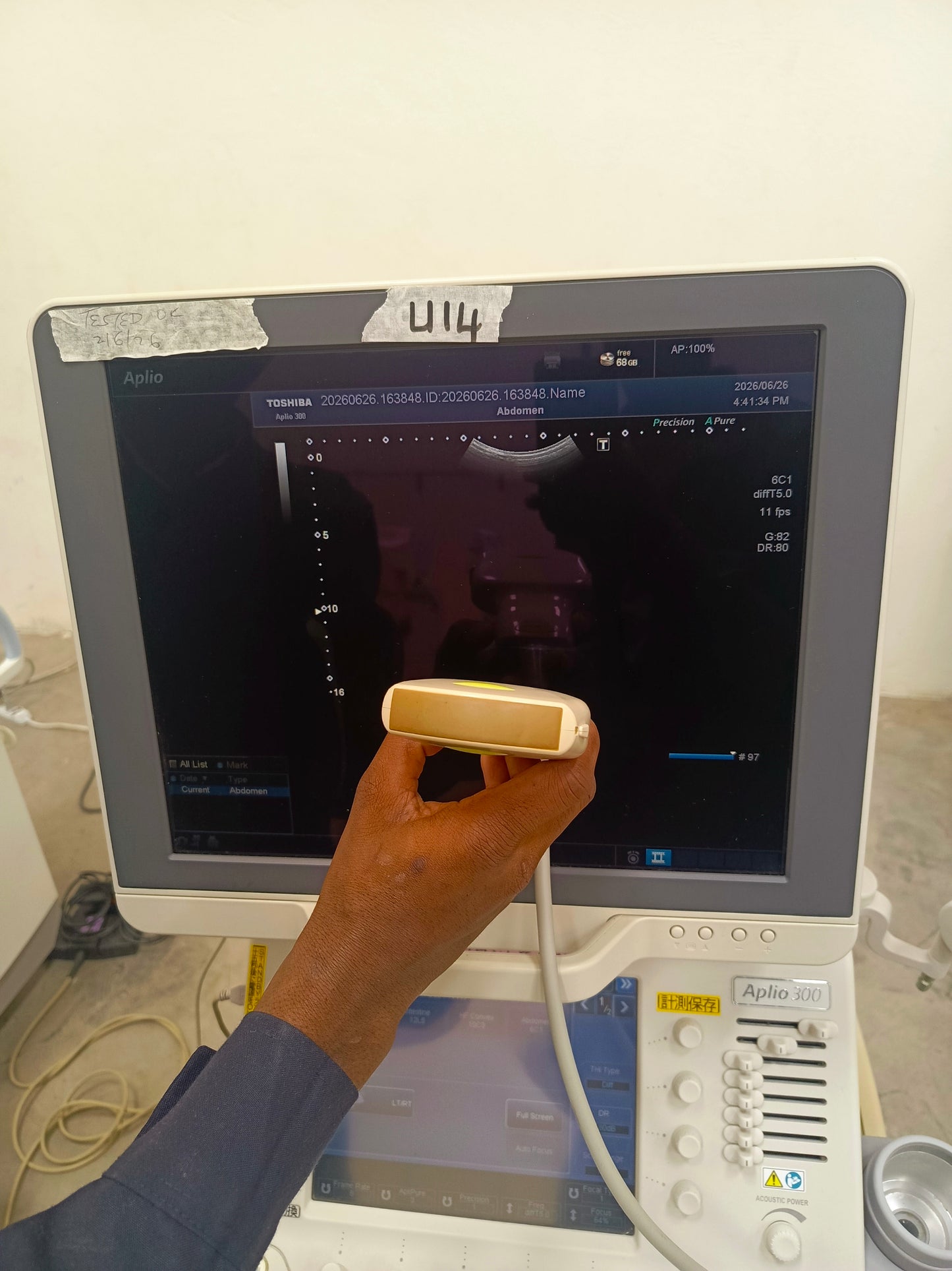 Toshiba aplio 300 ultrasound with convex probeandTVS probe Refurbished equipment. BH