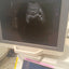 Toshiba aplio 300 ultrasound with convex probeandTVS probe Refurbished equipment. BH