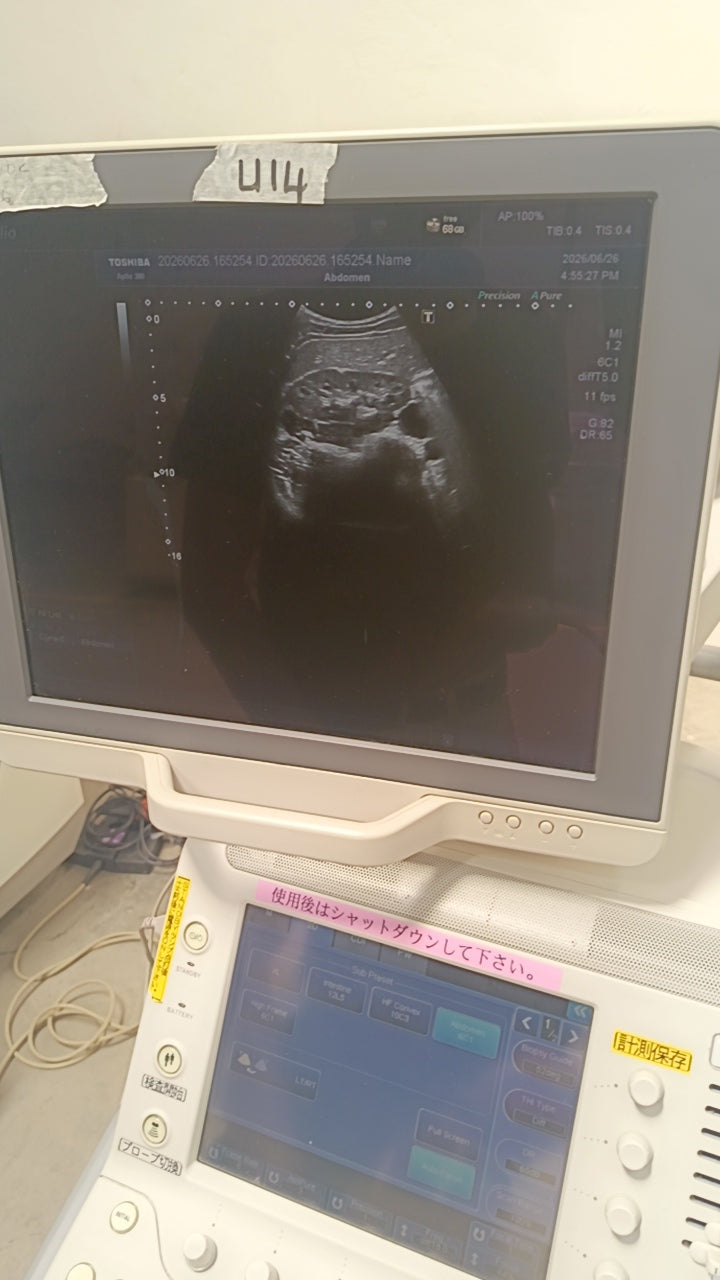 Toshiba aplio 300 ultrasound with convex probeandTVS probe Refurbished equipment. BH