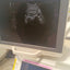Toshiba aplio 300 ultrasound with convex probeandTVS probe Refurbished equipment. BH