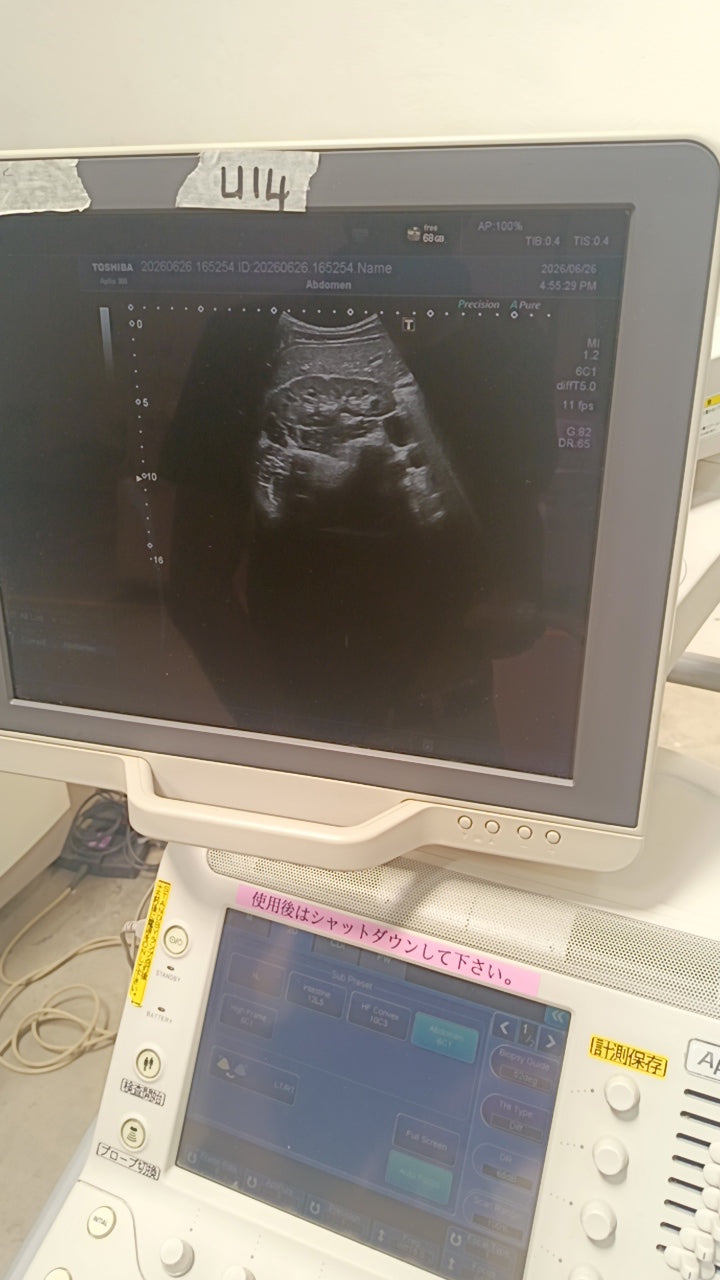 Toshiba aplio 300 ultrasound with convex probeandTVS probe Refurbished equipment. BH