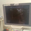 Toshiba aplio 300 ultrasound with convex probeandTVS probe Refurbished equipment. BH