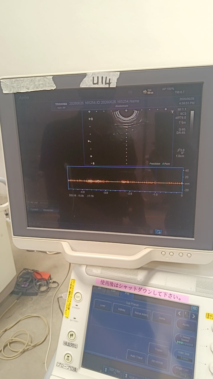 Toshiba aplio 300 ultrasound with convex probeandTVS probe Refurbished equipment. BH