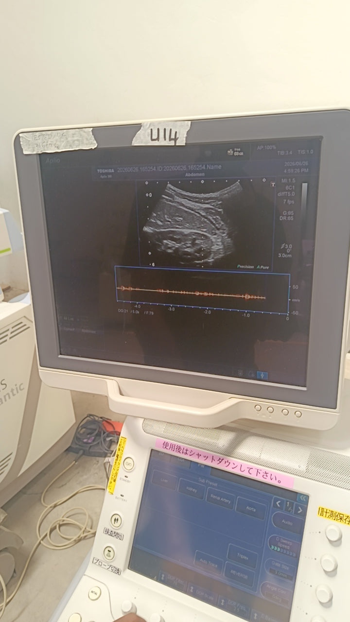 Toshiba aplio 300 ultrasound with convex probeandTVS probe Refurbished equipment. BH