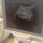 Toshiba aplio 300 ultrasound with convex probeandTVS probe Refurbished equipment. BH