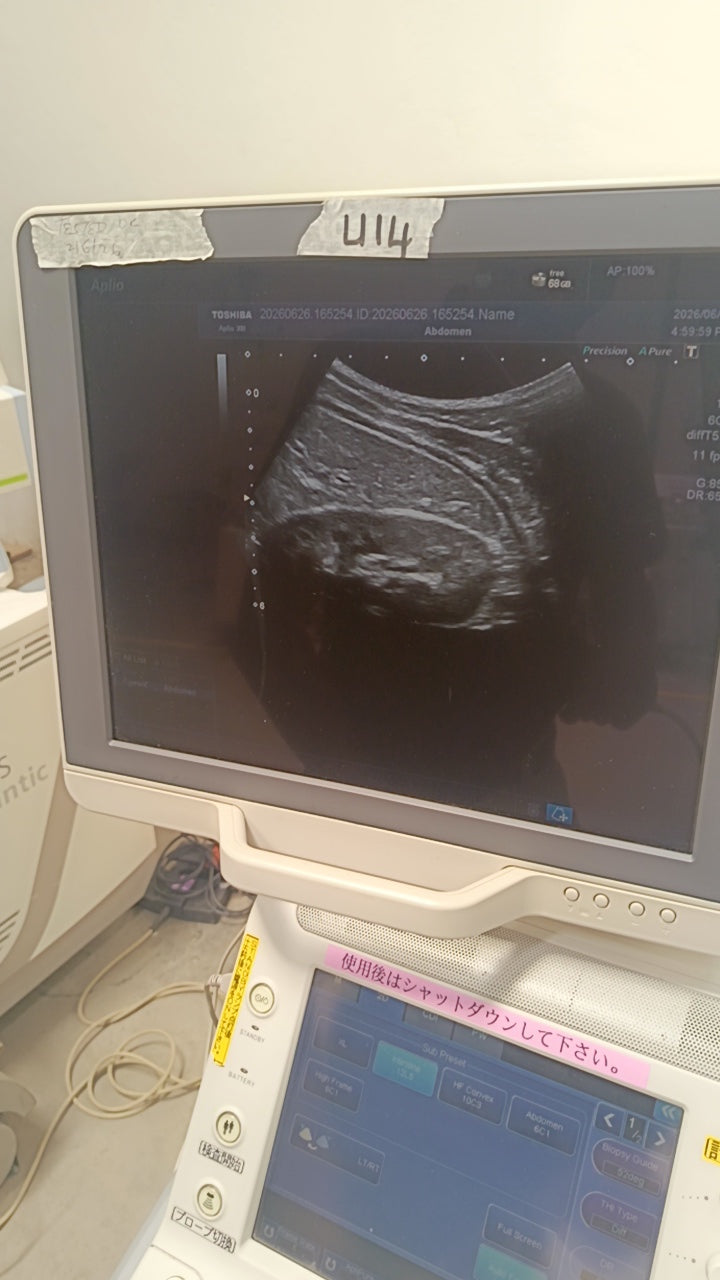 Toshiba aplio 300 ultrasound with convex probeandTVS probe Refurbished equipment. BH