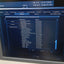 PHILIPS HD15 ULTRASOUND MACHINE with Cardiac Array probe. BH