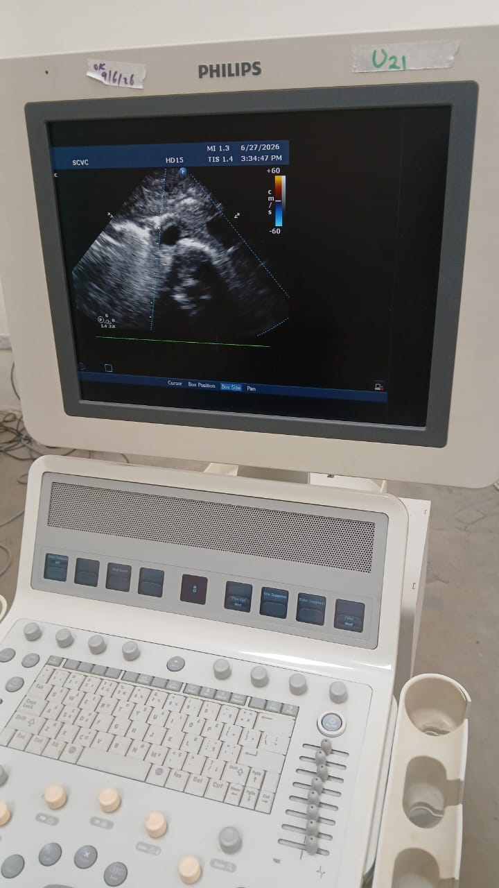 PHILIPS HD15 ULTRASOUND MACHINE with Cardiac Array probe. BH