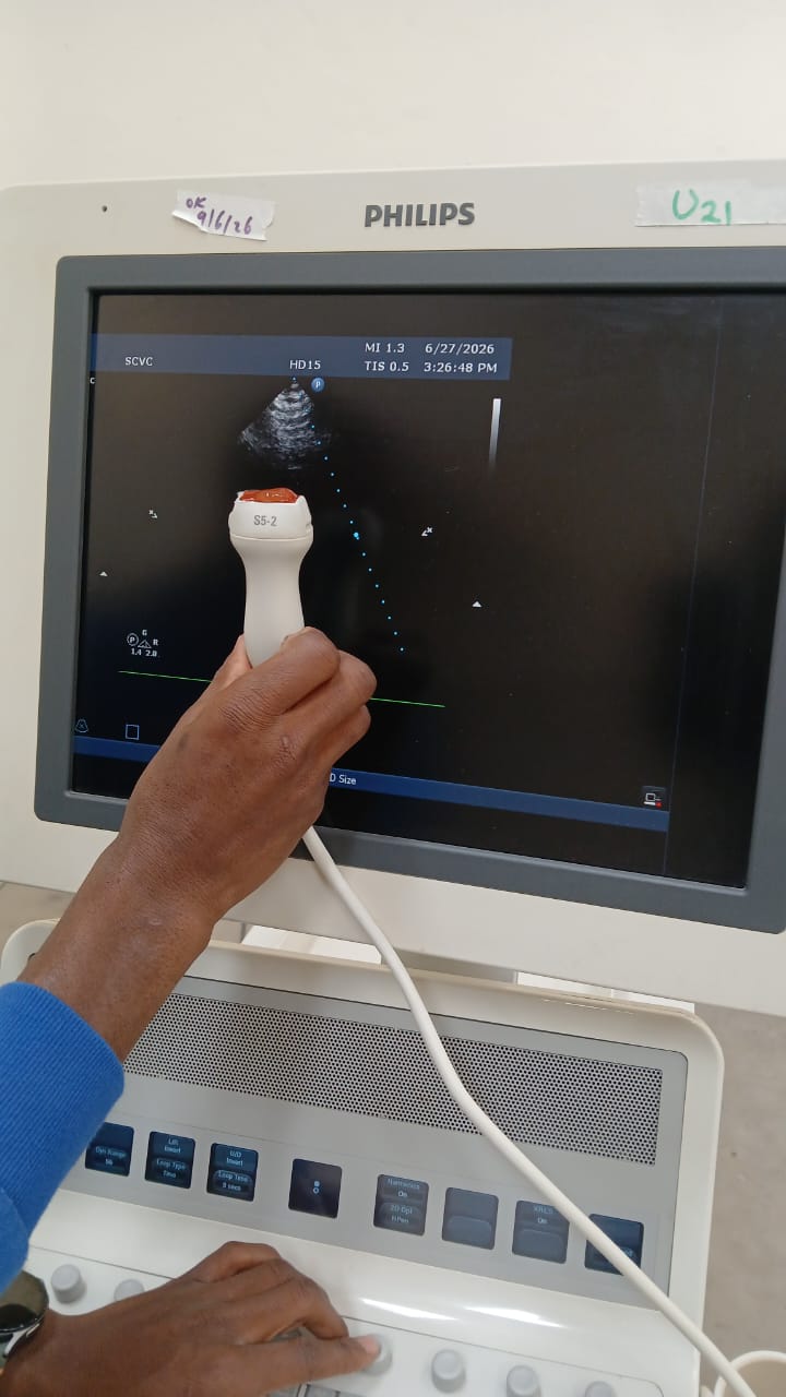 PHILIPS HD15 ULTRASOUND MACHINE with Cardiac Array probe. BH