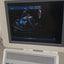PHILIPS HD15 ULTRASOUND MACHINE with Cardiac Array probe. BH