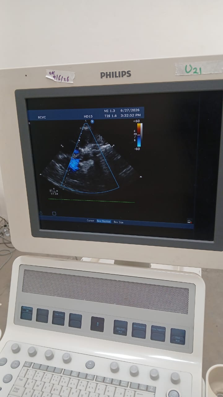 PHILIPS HD15 ULTRASOUND MACHINE with Cardiac Array probe. BH