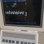 PHILIPS HD15 ULTRASOUND MACHINE with Cardiac Array probe. BH