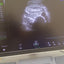 GE Voluson E8 BT16 4D Ultrasound System (2016) with RAB6-D Probe – HDlive – OB/GYN