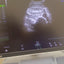 GE Voluson E8 BT16 4D Ultrasound System (2016) with RAB6-D Probe – HDlive – OB/GYN