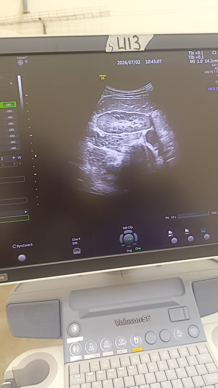 GE Voluson E8 BT16 4D Ultrasound System (2016) with RAB6-D Probe – HDlive – OB/GYN