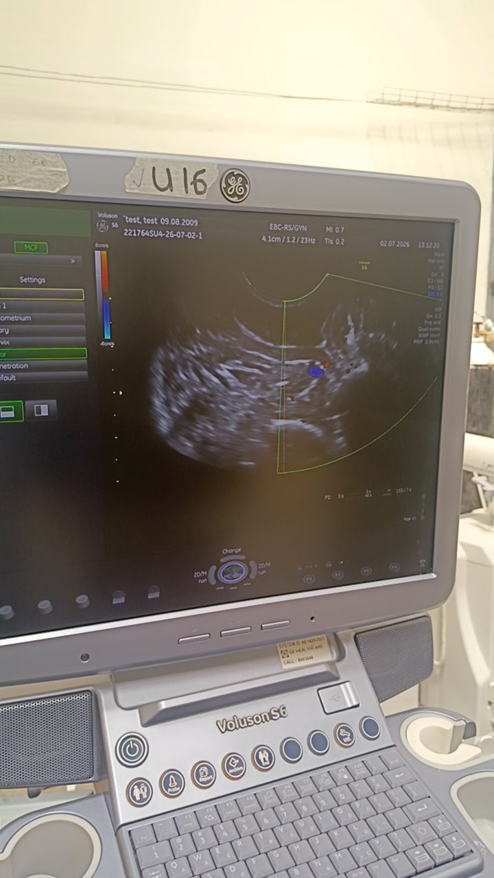GE Voluson E8 BT16 4D Ultrasound System (2016) with RAB6-D Probe – HDlive – OB/GYN