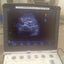 3C-Rs Convex probe for LOGIC e, logic-i, logic book, logic book xp, logic book xp pro, vivid-i, vivid-e, vivid-e