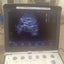 3C-Rs Convex probe for LOGIC e, logic-i, logic book, logic book xp, logic book xp pro, vivid-i, vivid-e, vivid-e