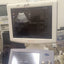 ALOKA UST-987-7.5 convex probe for Hitachi Aloka pro sound a6. BH