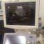 ALOKA UST-987-7.5 convex probe for Hitachi Aloka pro sound a6. BH