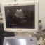 ALOKA UST-987-7.5 convex probe for Hitachi Aloka pro sound a6. BH