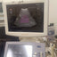 ALOKA UST-987-7.5 convex probe for Hitachi Aloka pro sound a6. BH