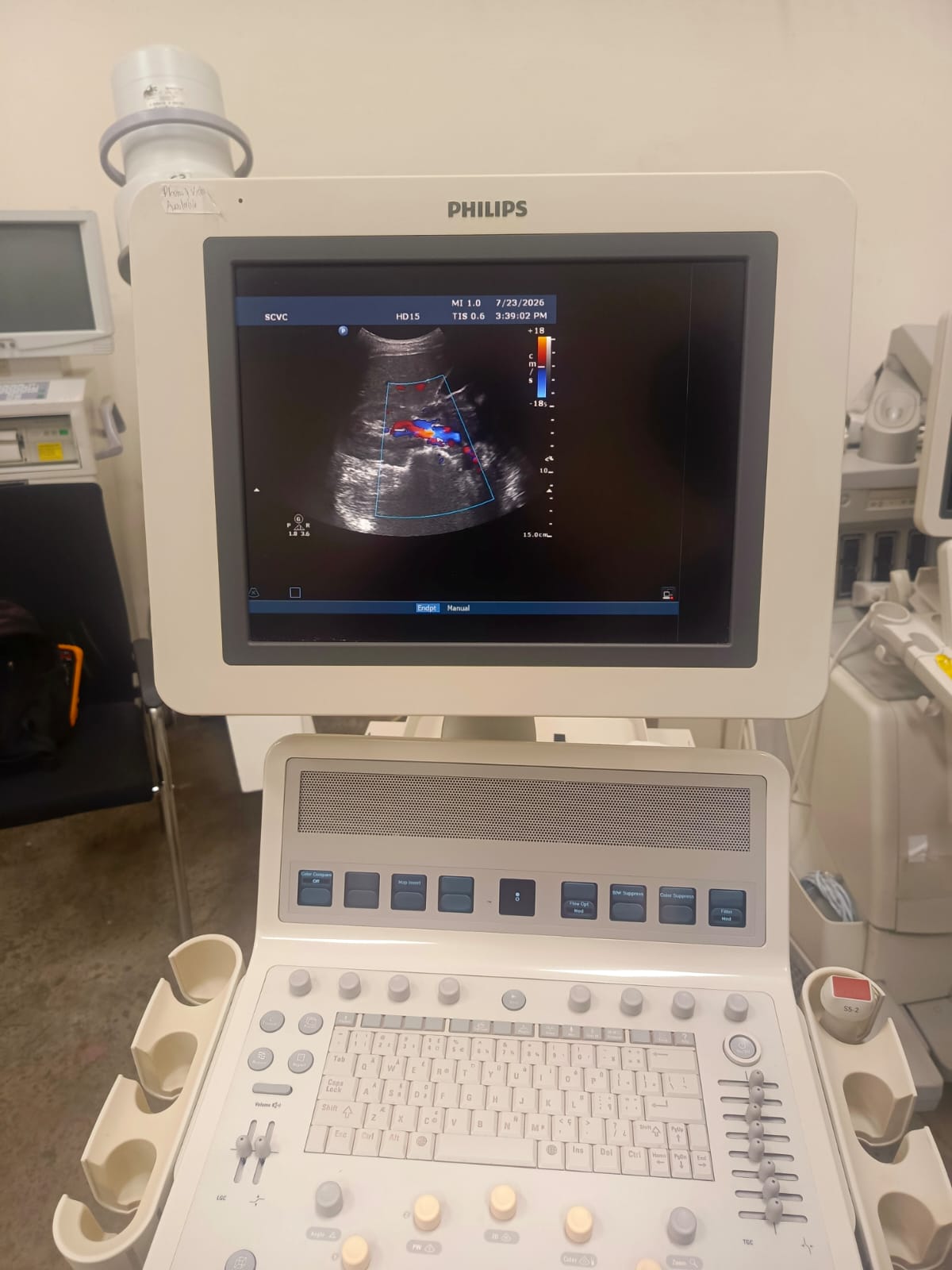 Philips C6-3 convex ultrasound probe for Philips HD15, HD11, HD11XE, HD9, HD7, HD7XE, ultrasound machines. BH