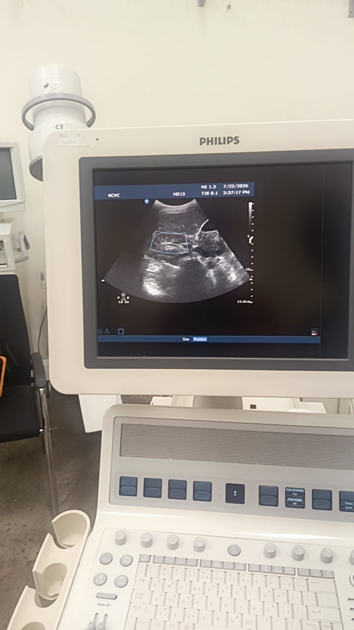 Philips C6-3 convex ultrasound probe for Philips HD15, HD11, HD11XE, HD9, HD7, HD7XE, ultrasound machines. BH