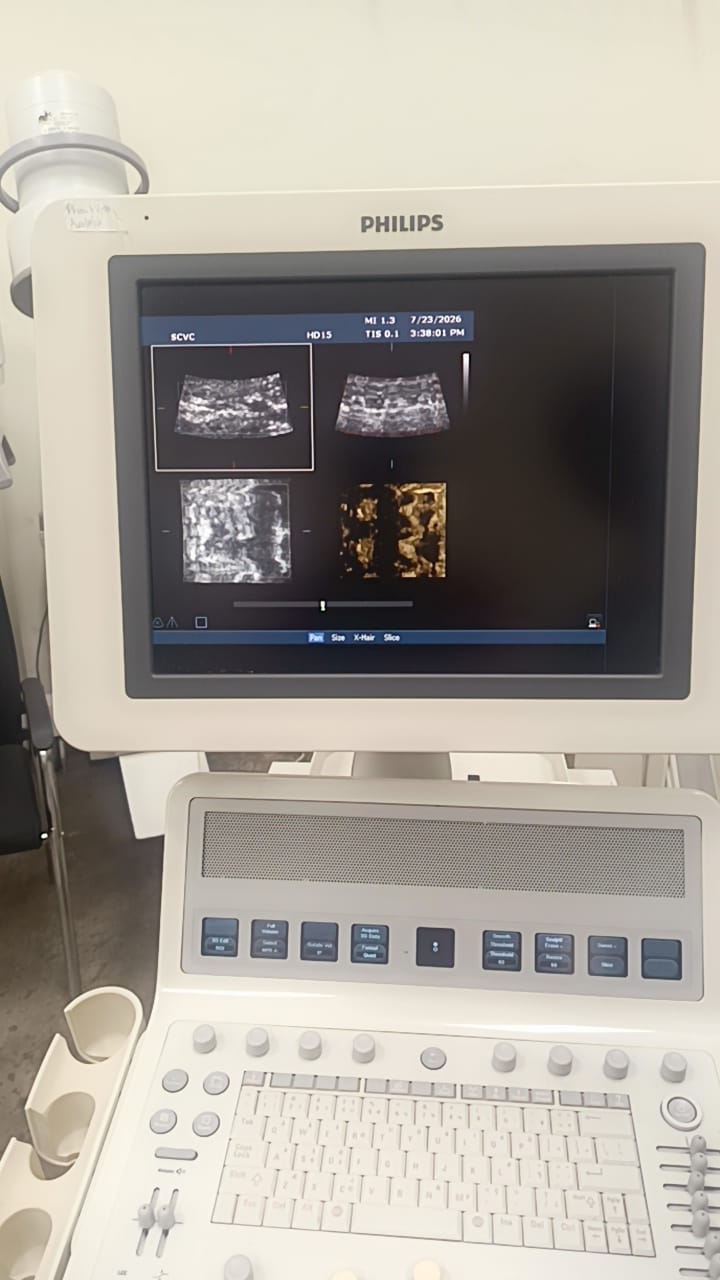 Philips C6-3 convex ultrasound probe for Philips HD15, HD11, HD11XE, HD9, HD7, HD7XE, ultrasound machines. BH