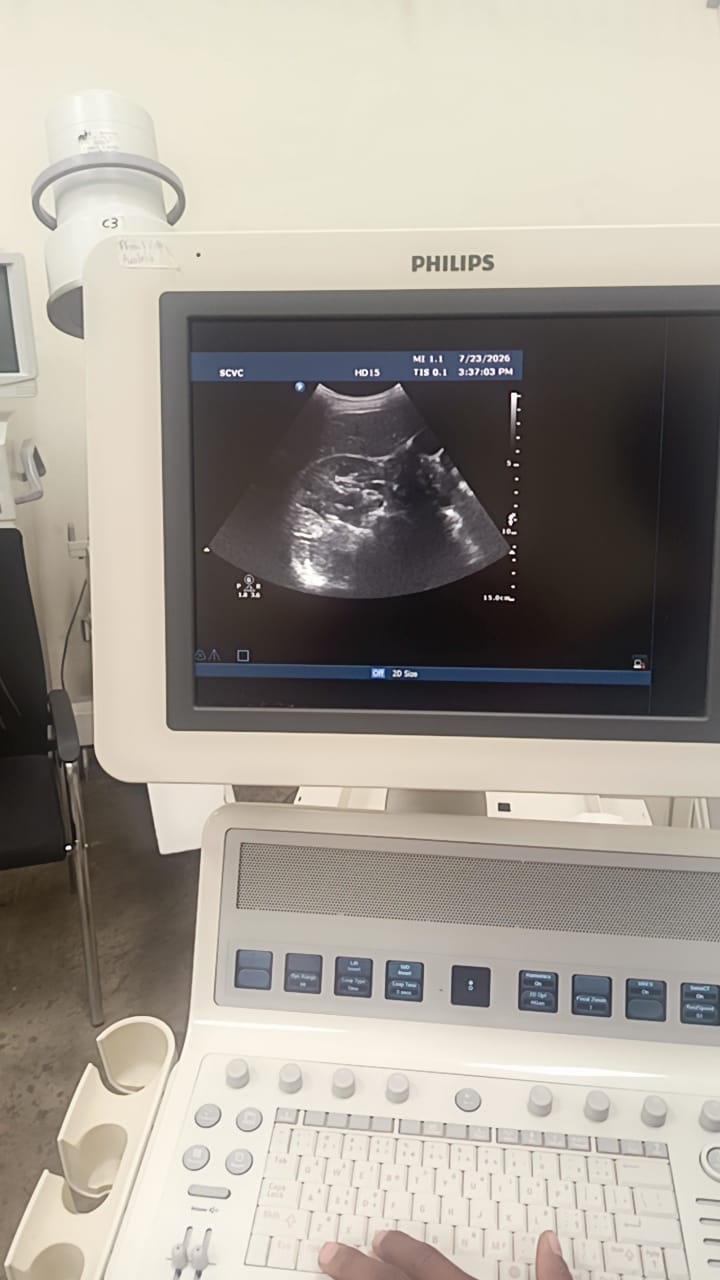 Philips C6-3 convex ultrasound probe for Philips HD15, HD11, HD11XE, HD9, HD7, HD7XE, ultrasound machines. BH