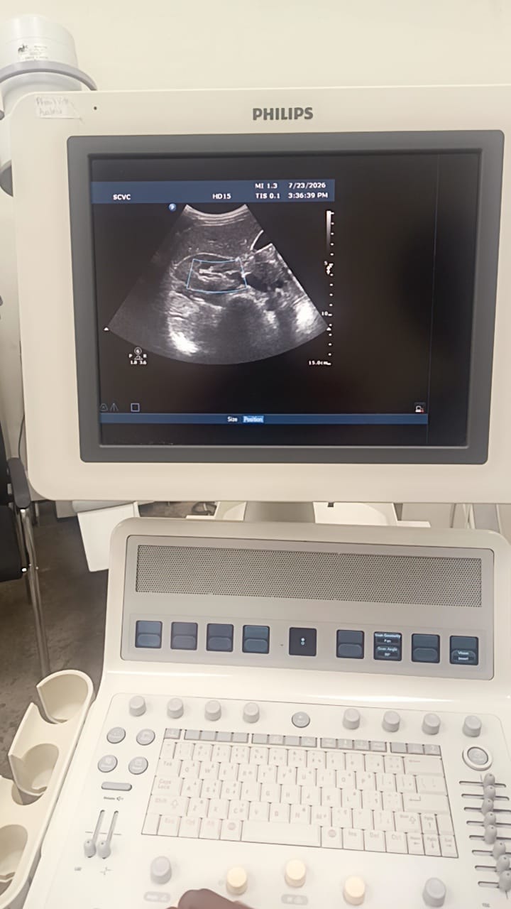 Philips C6-3 convex ultrasound probe for Philips HD15, HD11, HD11XE, HD9, HD7, HD7XE, ultrasound machines. BH