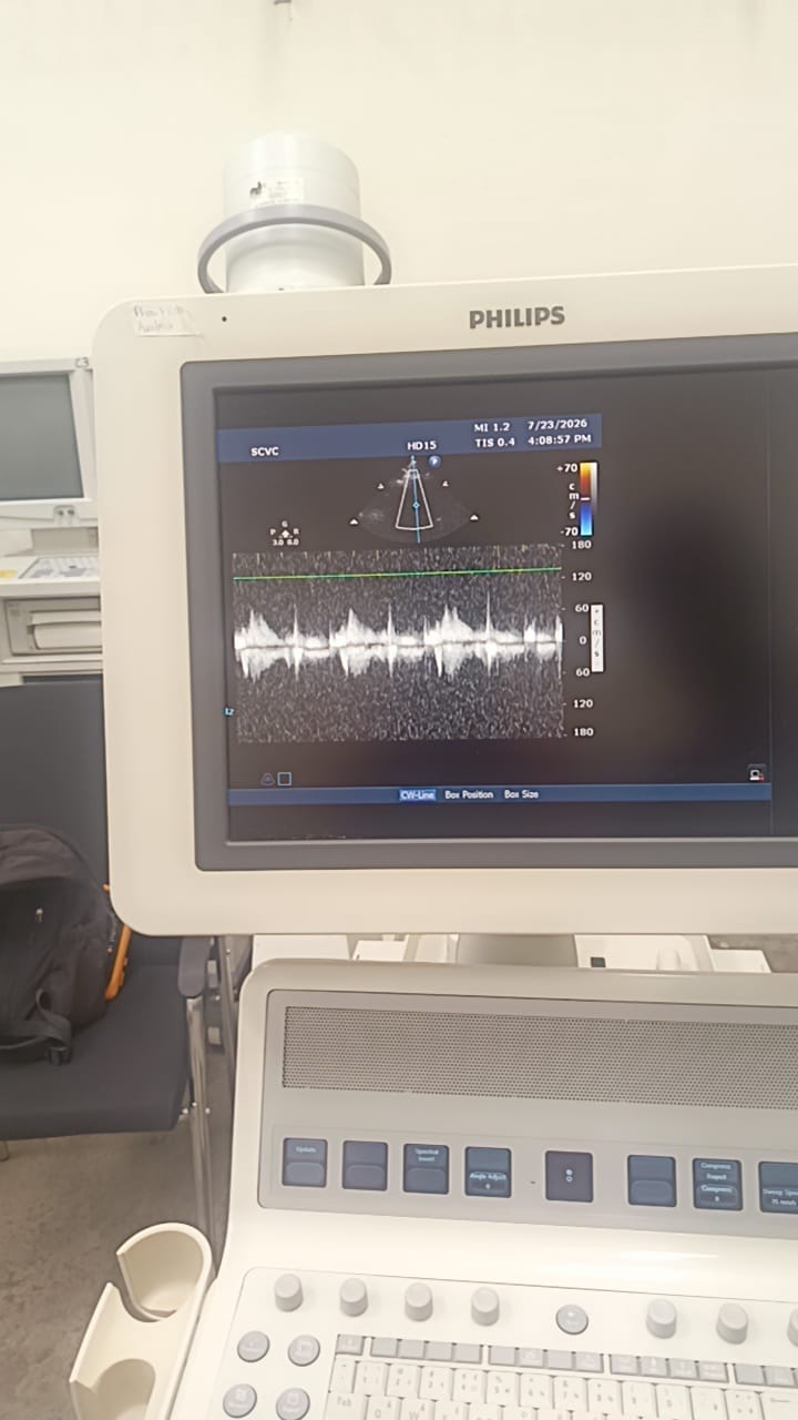 Philips S8-3 ultrasound probe for Philips iU22, iE33, HD11/HD11 XE, HD15 and EPIQ 7 ultrasound machines. BH