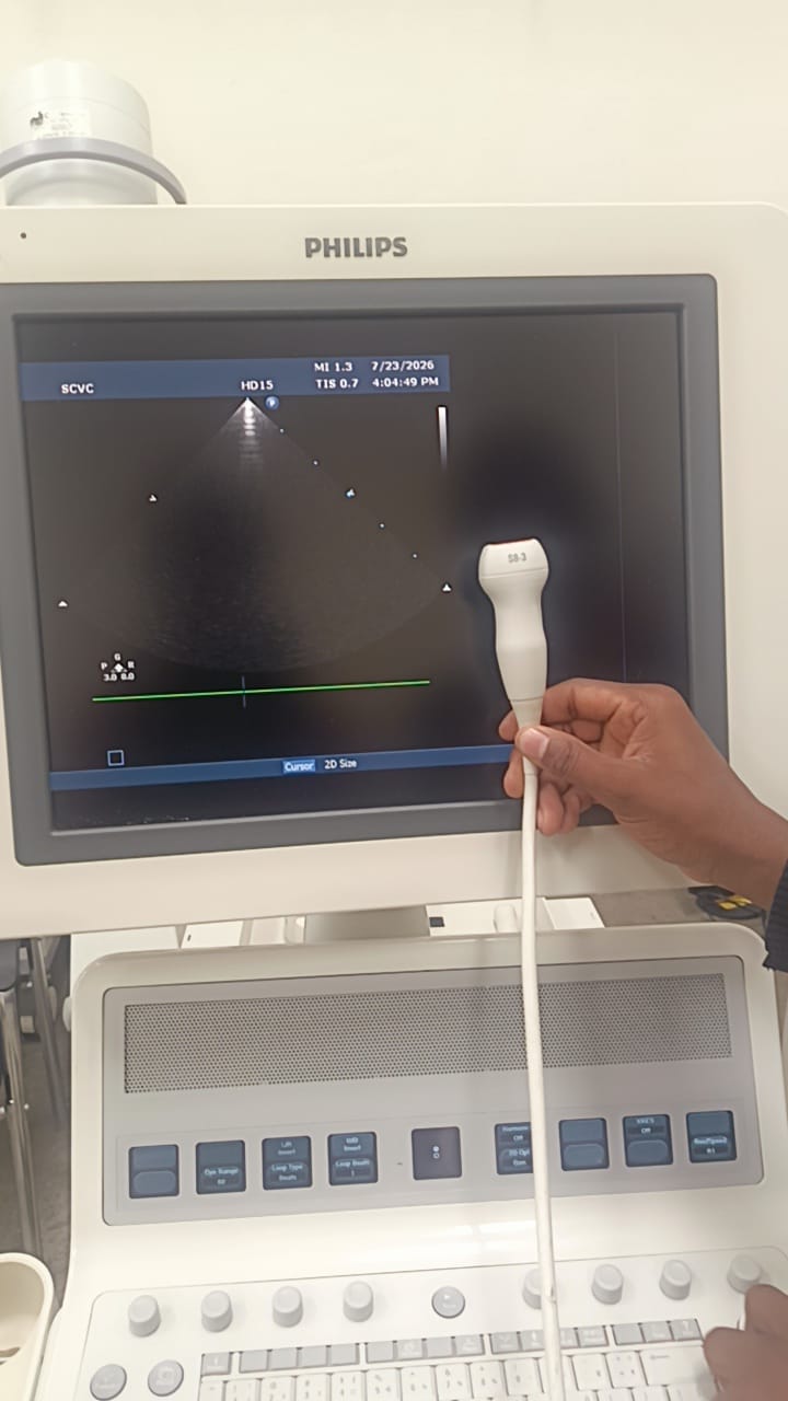 Philips S8-3 ultrasound probe for Philips iU22, iE33, HD11/HD11 XE, HD15 and EPIQ 7 ultrasound machines. BH