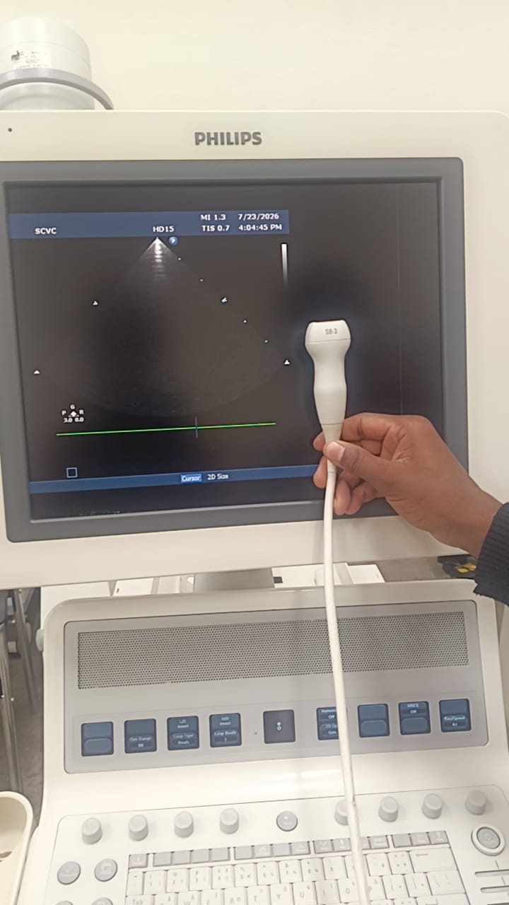 Philips S8-3 ultrasound probe for Philips iU22, iE33, HD11/HD11 XE, HD15 and EPIQ 7 ultrasound machines. BH