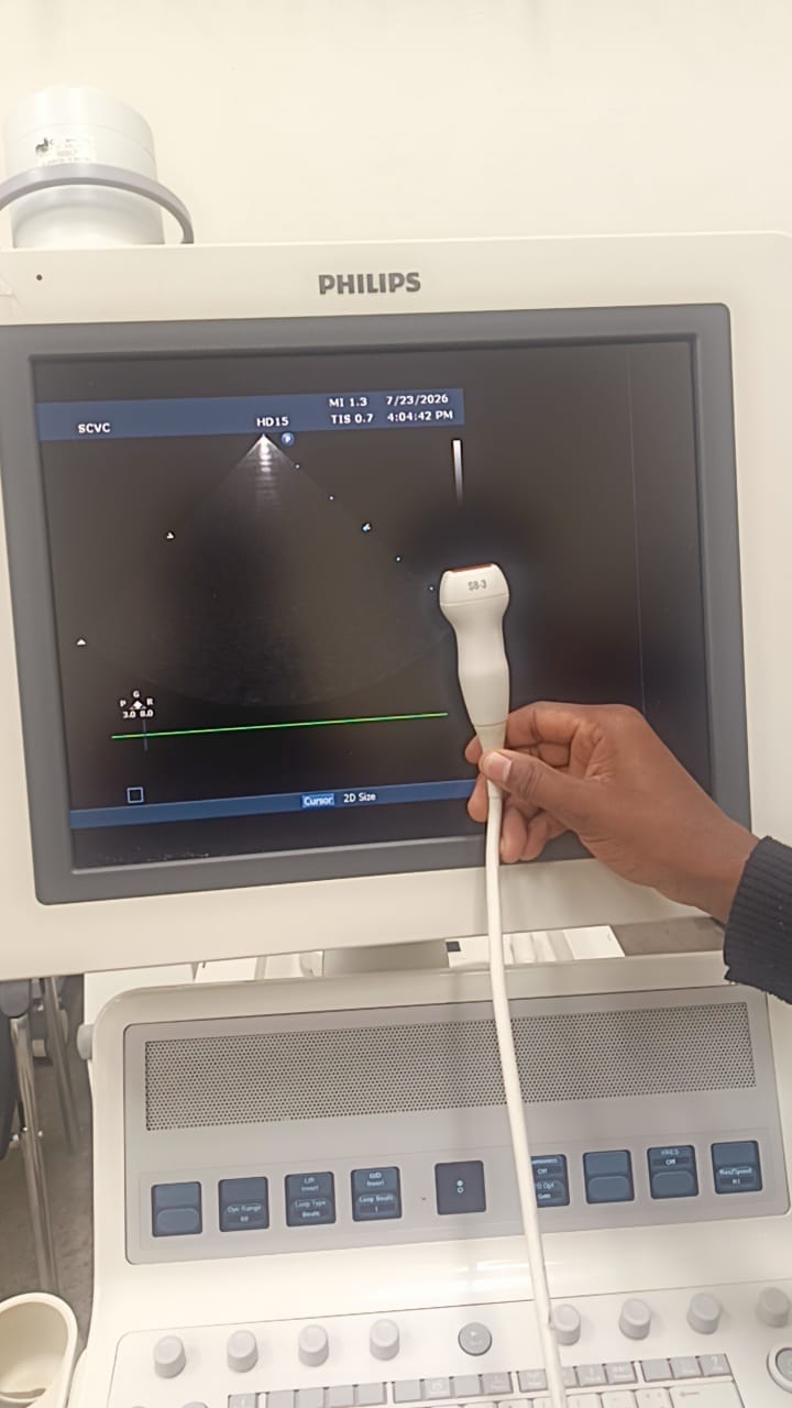 Philips S8-3 ultrasound probe for Philips iU22, iE33, HD11/HD11 XE, HD15 and EPIQ 7 ultrasound machines. BH