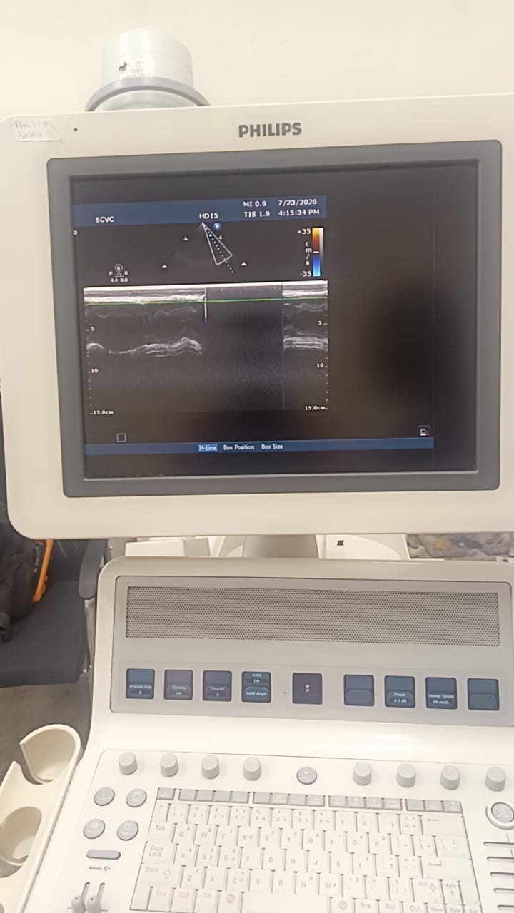Philips S8-3 ultrasound probe for Philips iU22, iE33, HD11/HD11 XE, HD15 and EPIQ 7 ultrasound machines. BH