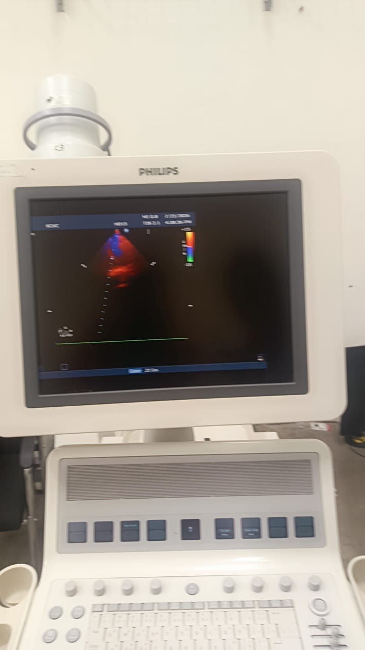 Philips S12-4 cardiac array probe for HD11XE, HD11, iE33, HD15, CX50 Philips ultrasound machines. BH(2)