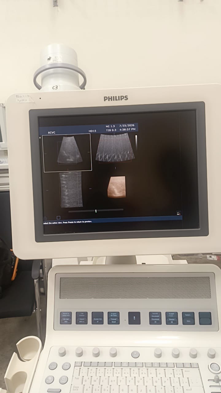 Philips S12-4 cardiac array probe for HD11XE, HD11, iE33, HD15, CX50 Philips ultrasound machines. BH(2)