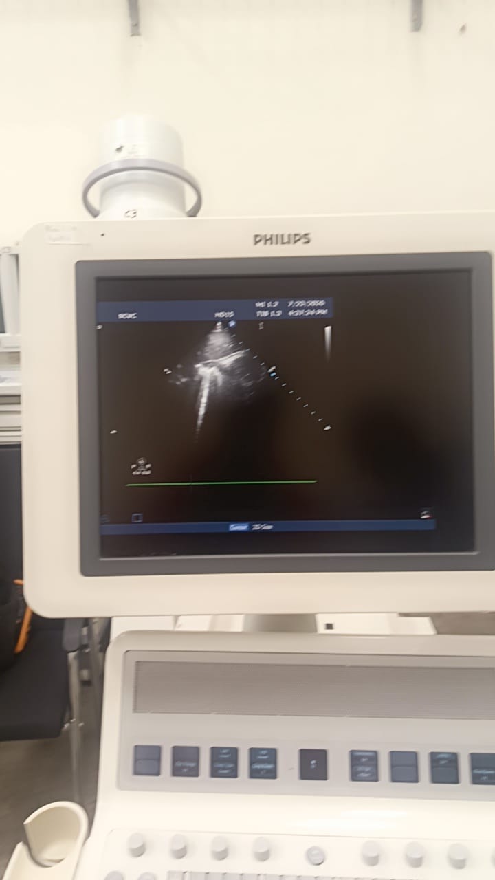 Philips S12-4 cardiac array probe for HD11XE, HD11, iE33, HD15, CX50 Philips ultrasound machines. BH(2)