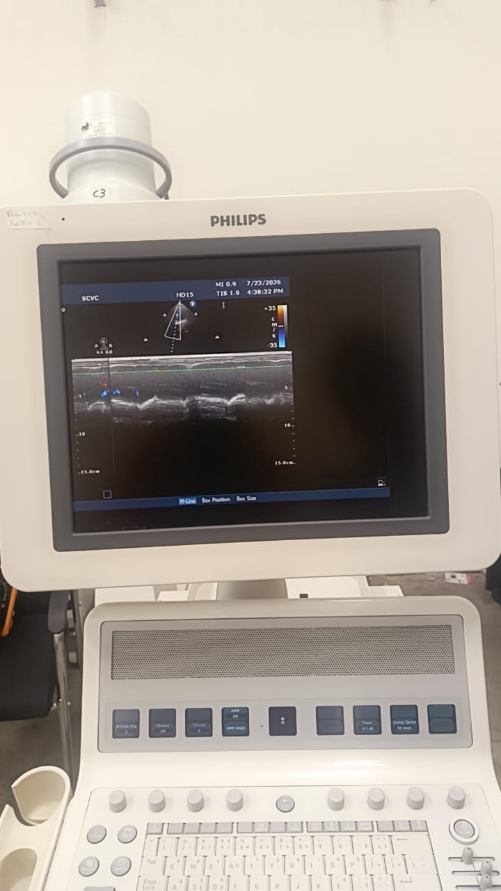 Philips S12-4 cardiac array probe for HD11XE, HD11, iE33, HD15, CX50 Philips ultrasound machines. BH(2)