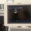 Philips S12-4 cardiac array probe for HD11XE, HD11, iE33, HD15, CX50 Philips ultrasound machines. BH(2)