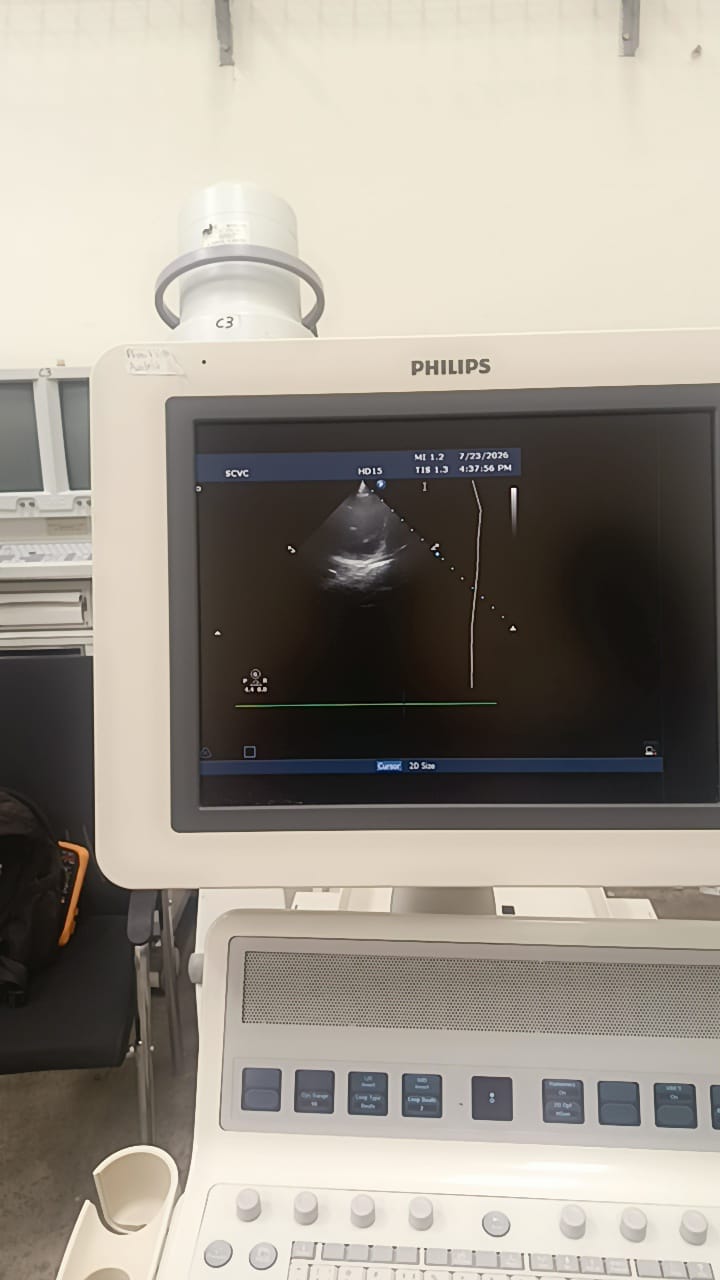 Philips S12-4 cardiac array probe for HD11XE, HD11, iE33, HD15, CX50 Philips ultrasound machines. BH(2)