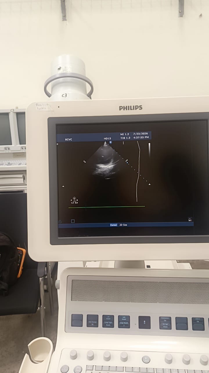 Philips S12-4 cardiac array probe for HD11XE, HD11, iE33, HD15, CX50 Philips ultrasound machines. BH(2)