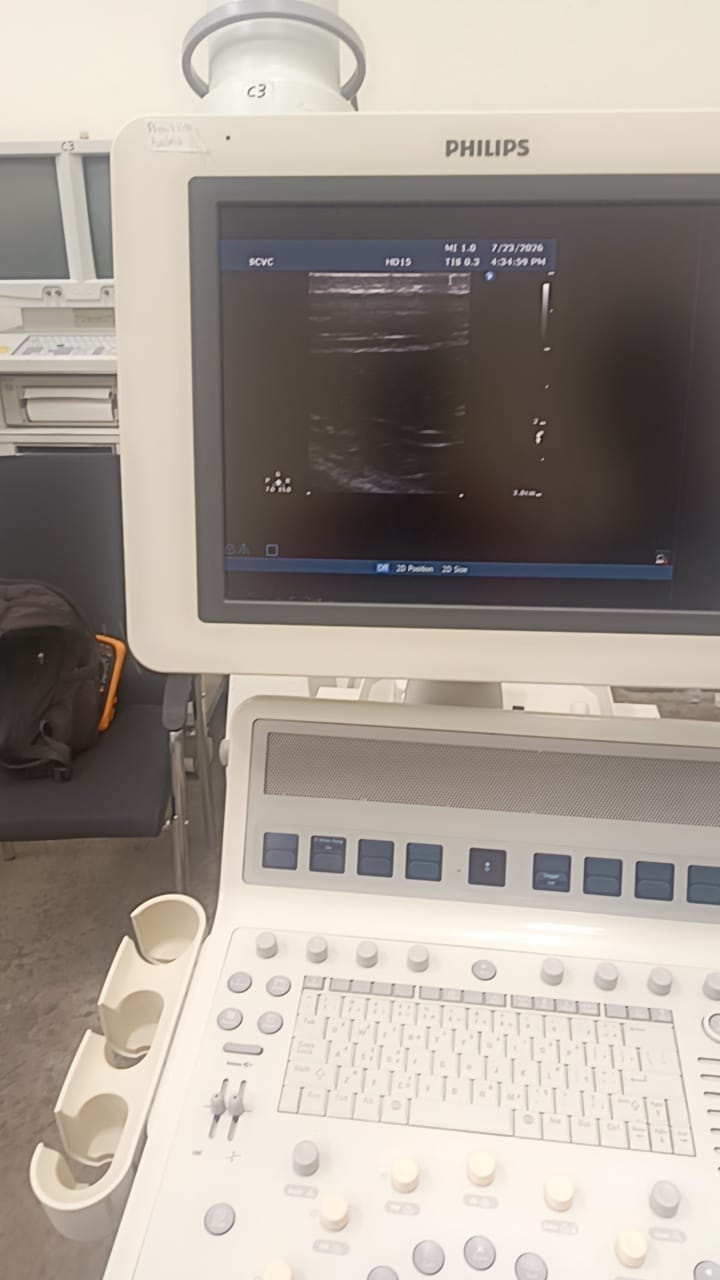 Philips L15-7i0 Linear ultrasound probe for iU22,iE33,HD15,HD11XE,CX50
CX30 ultrasound machines. BH