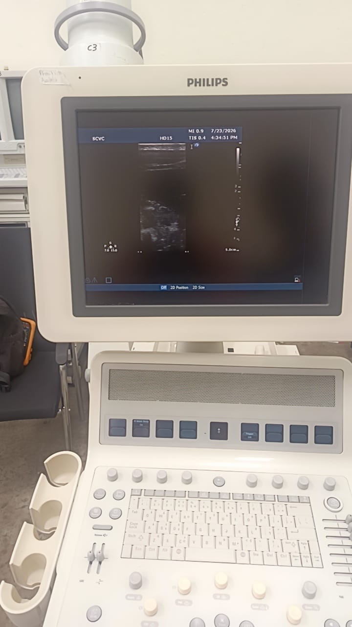 Philips L15-7i0 Linear ultrasound probe for iU22,iE33,HD15,HD11XE,CX50
CX30 ultrasound machines. BH