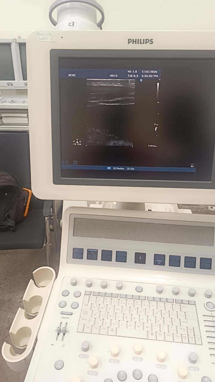 Philips L15-7i0 Linear ultrasound probe for iU22,iE33,HD15,HD11XE,CX50
CX30 ultrasound machines. BH