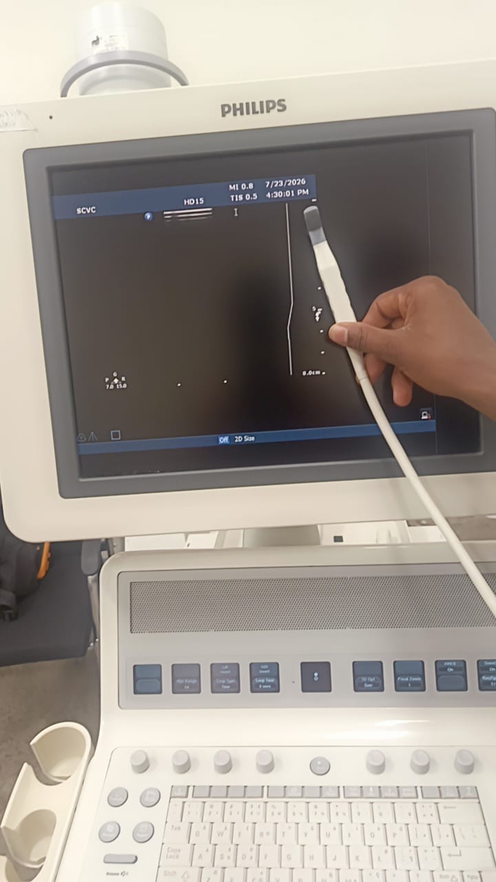 Philips L15-7i0 Linear ultrasound probe for iU22,iE33,HD15,HD11XE,CX50
CX30 ultrasound machines. BH