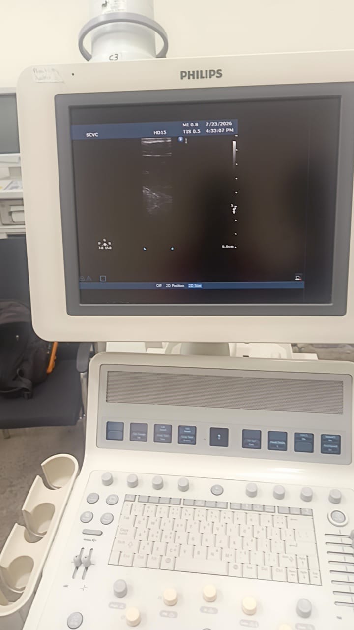 Philips L15-7i0 Linear ultrasound probe for iU22,iE33,HD15,HD11XE,CX50
CX30 ultrasound machines. BH